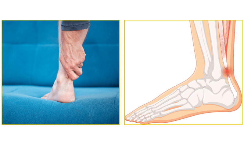 Minimally invasive Achilles tendon surgery and repair at Chicago Foot Care Clinic