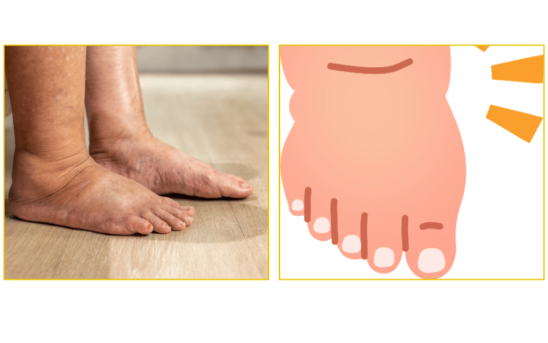 Diabetic foot screening and wound prevention treatment at Chicago Foot Care Clinic
