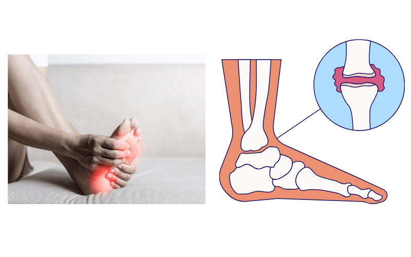 Clinical evaluation and joint pain treatment for foot arthritis at Chicago Foot Care Clinic