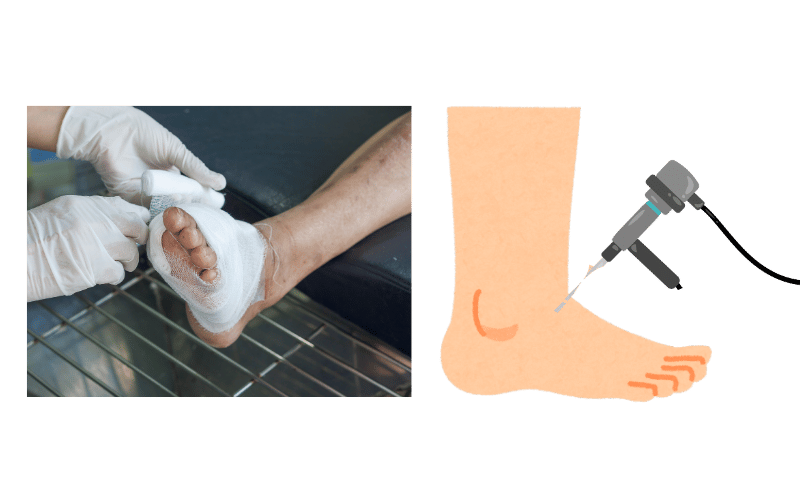 Minimally invasive foot arthroscopy and joint repair surgery at Chicago Foot Care Clinic