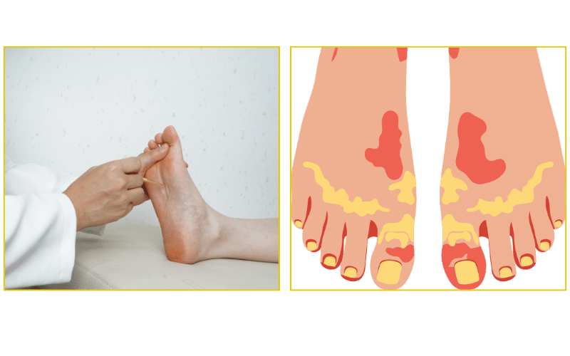 Treatment for common foot diseases and painful conditions at Chicago Foot Care Clinic