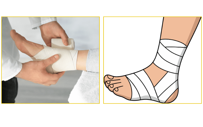 Digital X-ray evaluation and casting for a foot fracture at Chicago Foot Care Clinic