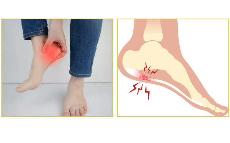 Heel pain treatment and plantar fasciitis relief at Chicago Foot Care Clinic